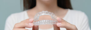 bellaire clearcorrect aligners
