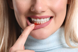 Contemporary Dental in Bellaire offers periodontal services