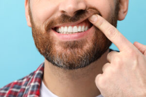 Bellaire, TX, dentist offers treatment for gingivitis with scaling and root planings 